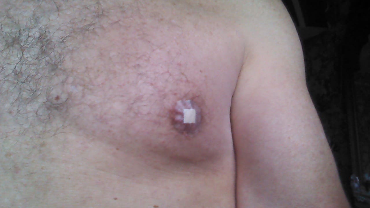 Nipple Bandages